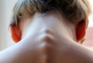 Read more about the article Zdrowszy Kołobrzeg: zadbaj o swój kręgosłup na koszt miasta